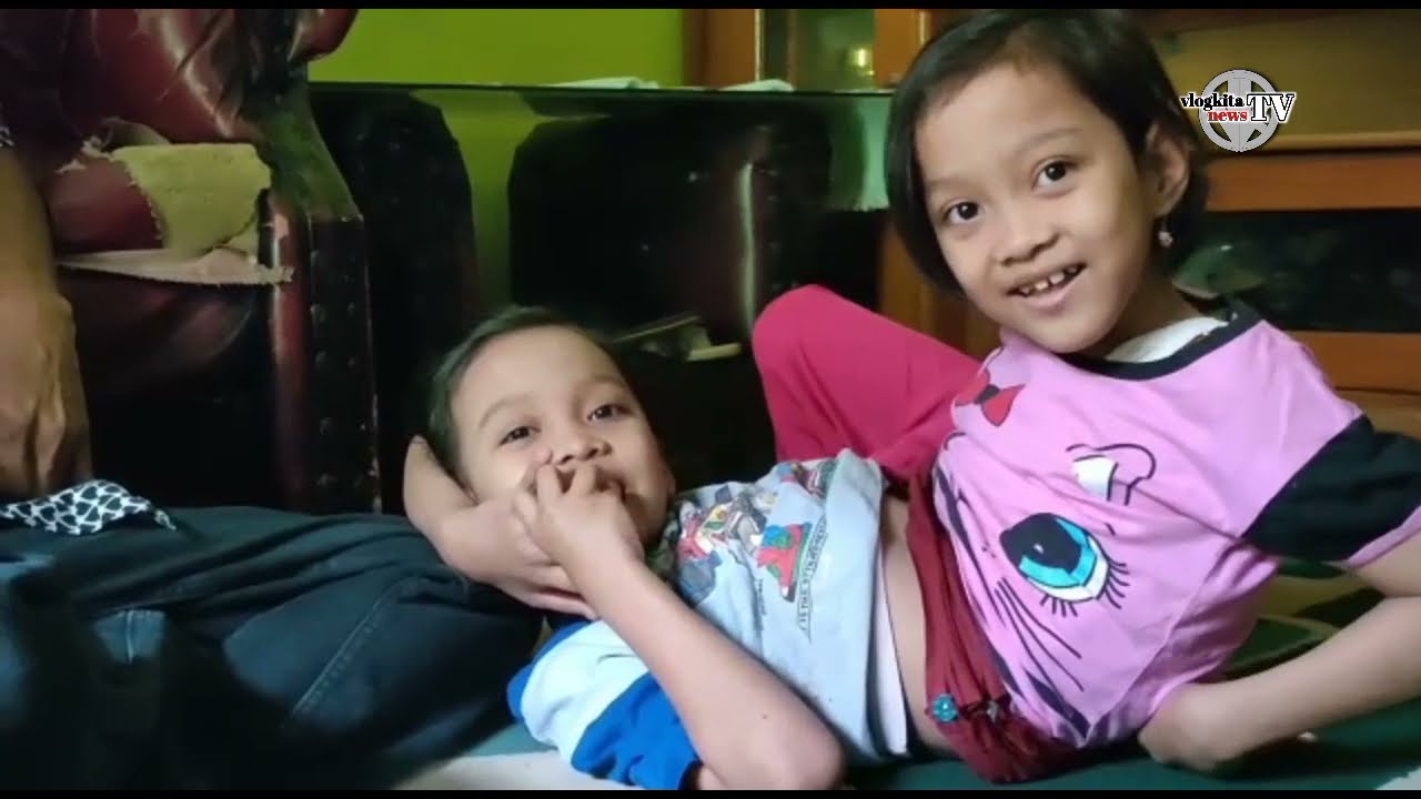 Anak Kembar Siam Asal Garut, Semangat Jalani Hidup