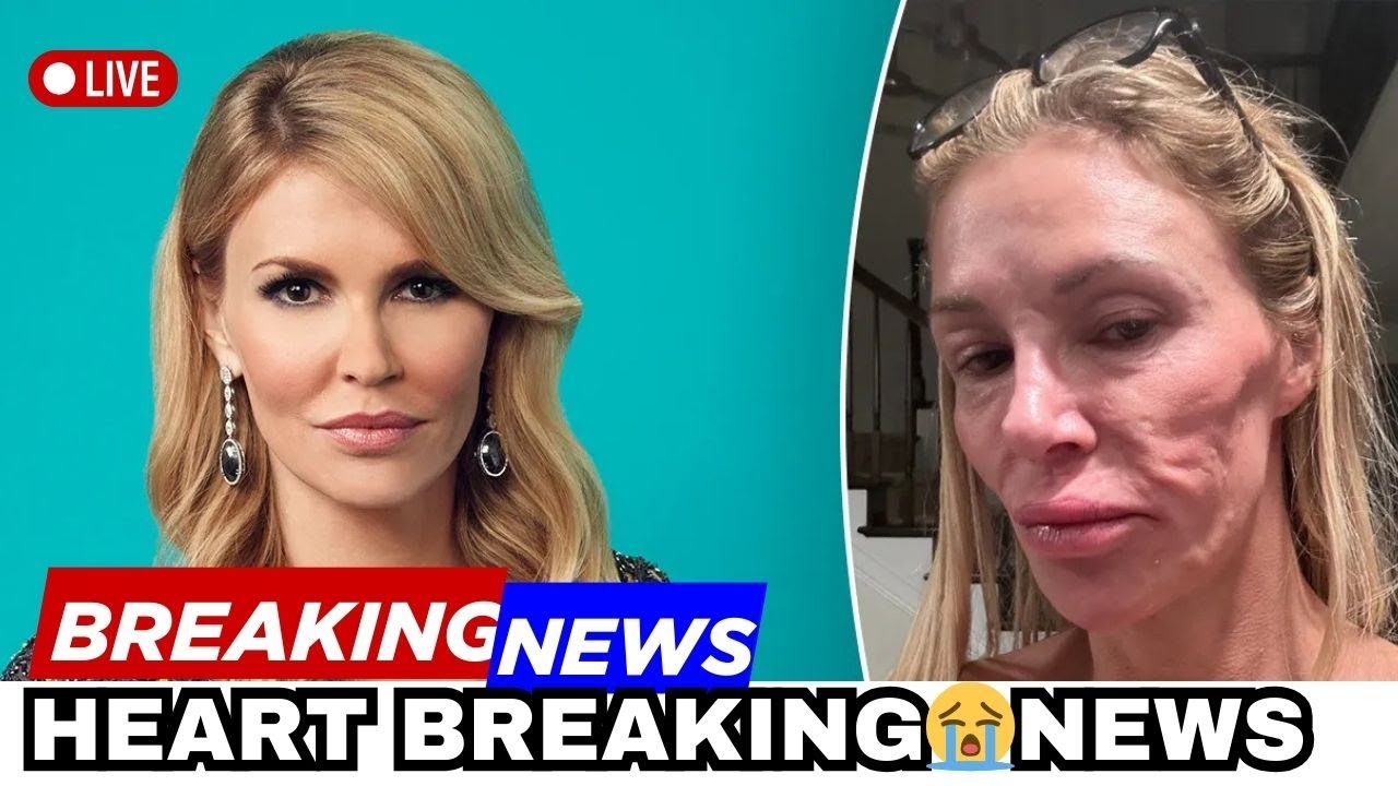 😭Real Housewives Star Brandi Glanville Heartbreaking Transformation After Parasite Shocker Must See