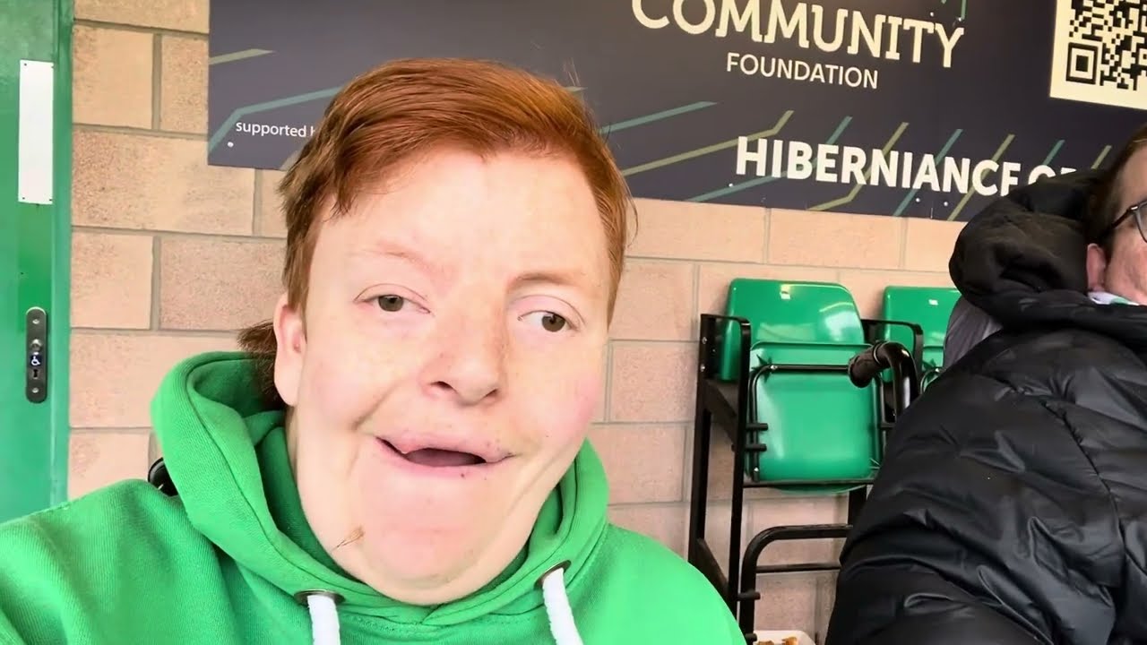 Hibernian 4-0 Livingston MATCHDAY VLOG #11 