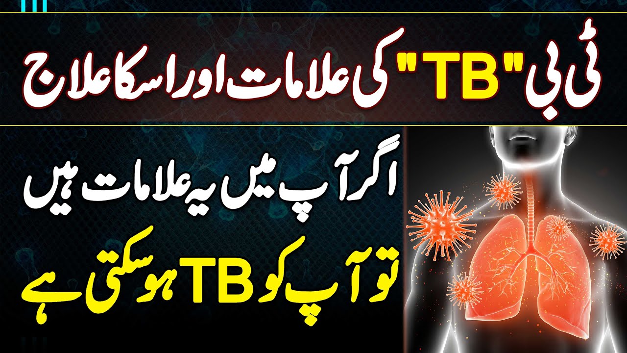 TB Symptoms & Treatment - Tuberculosis Treatment - TB Ki Alamat or TB Ka Ilaj - TB Ka Test Konsa Ha