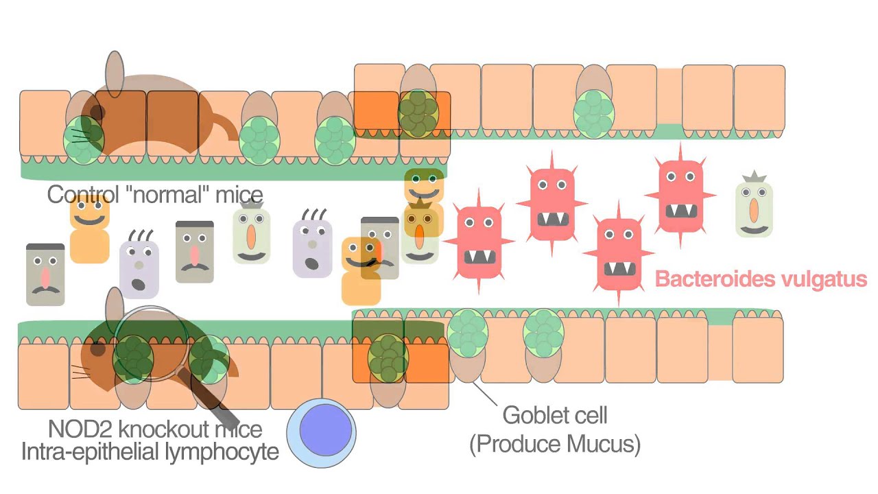 Crohn's Disease Gene Nod2 Regulates Intestinal Microbiota