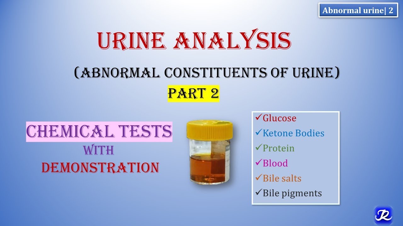 2: Abnormal Urine | Part 2 | Urine Analysis | Chemical Tests | Biochemistry | N'JOY Biochemistry