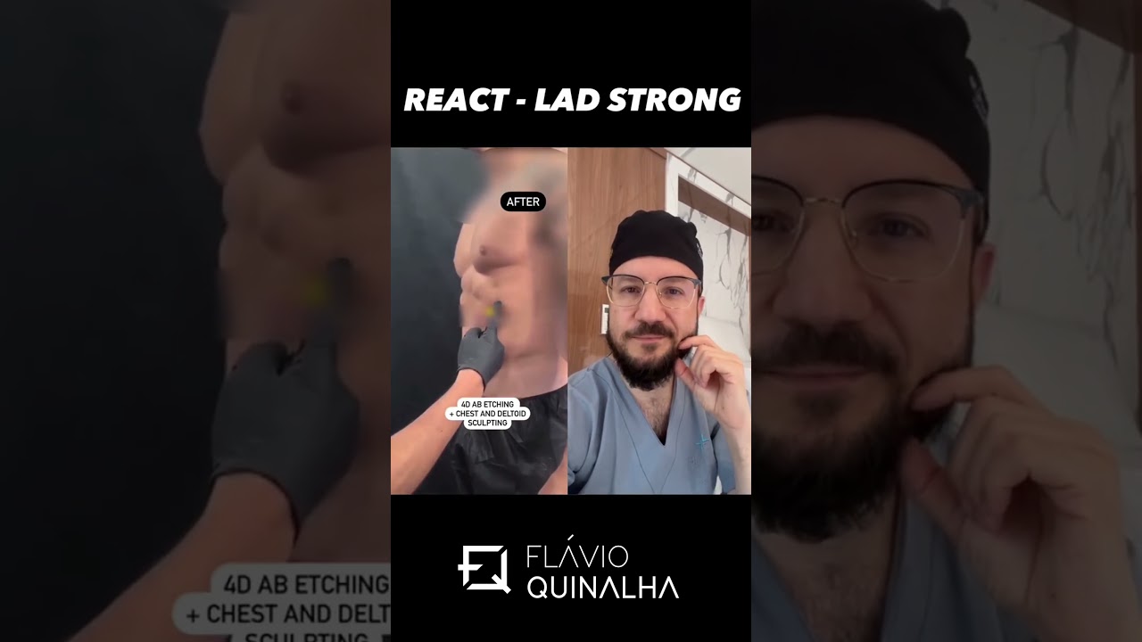 LIPO HD MASCULINA - LAD STRONG. O QUE ACHA? FARIA? #lipohdmasculina #ladstrong
