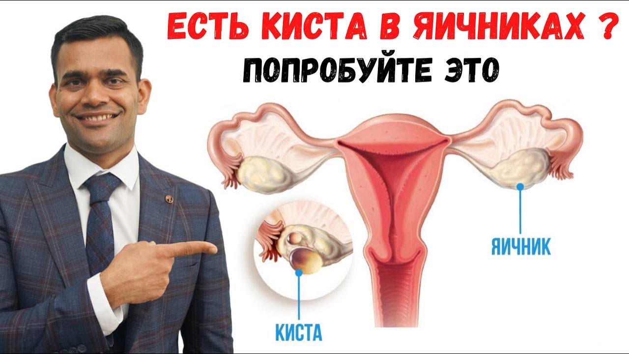 Есть Киста В Яичниках? Попробуйте Это | Доктор Вивек Джоши