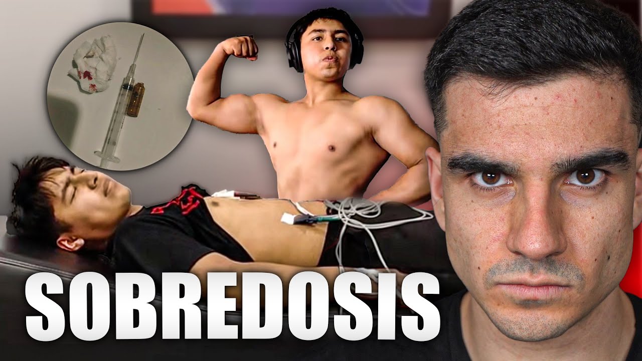 Solo 5 Días con Esteroides y termina en el Hospital (lamentable)