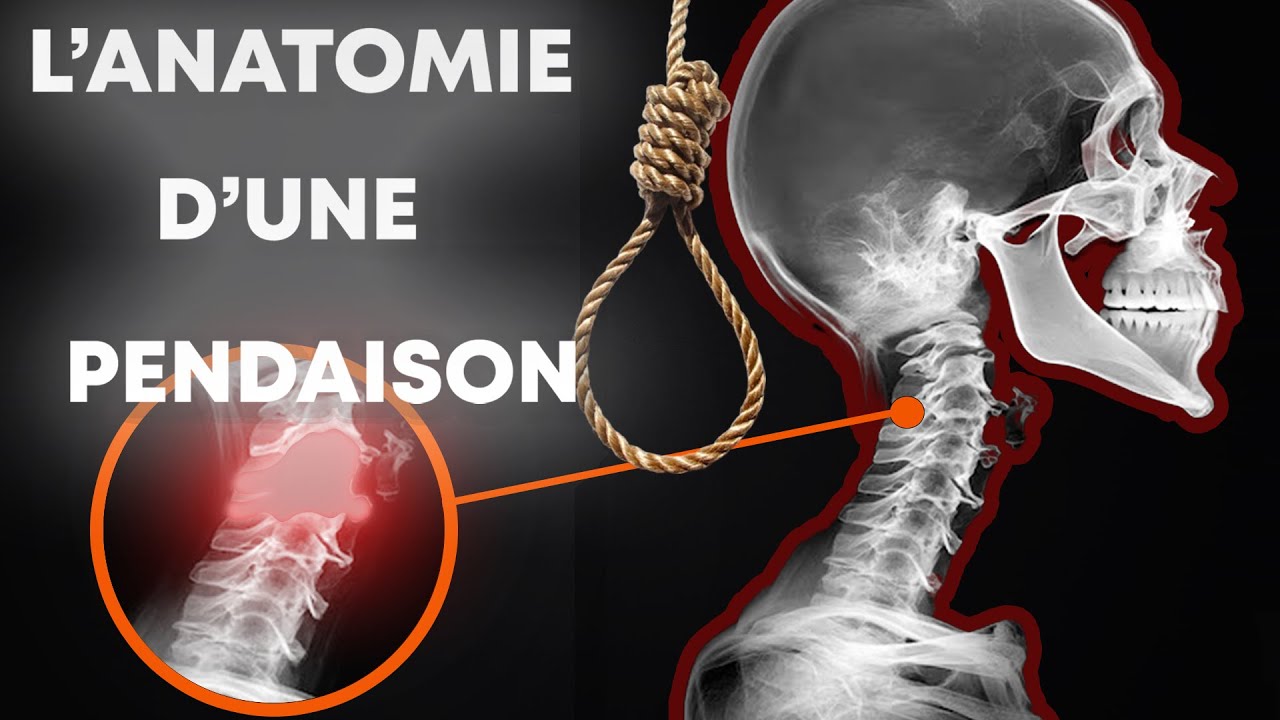 La SCIENCE derri&egrave;re la M0rt par PENDAISON