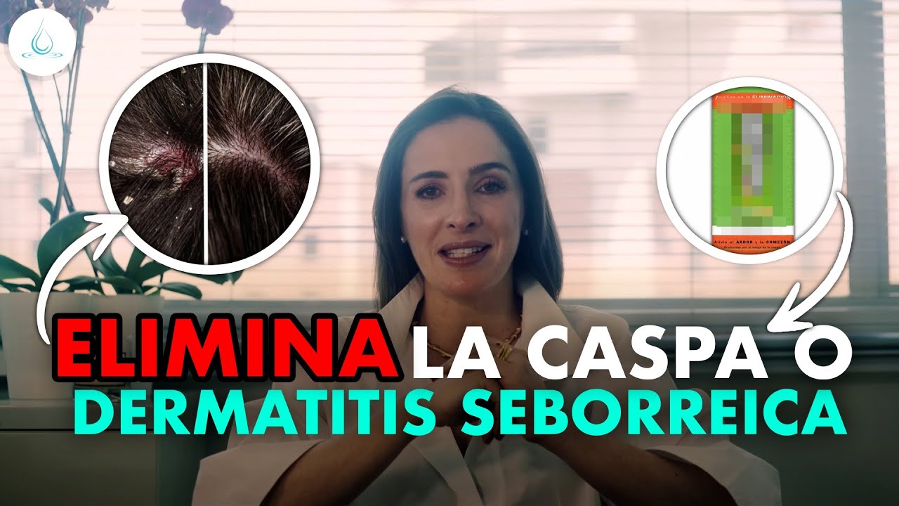🔴 CASPA | Dermatitis seborreica, TODO lo que tienes que saber@drapilarochoa  - Dermatologa