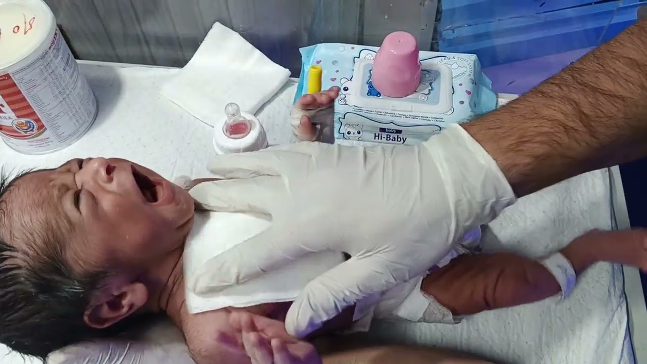 Safe Formula Feeding Technique for Newborns in the NICU | Step-by-Step Guide