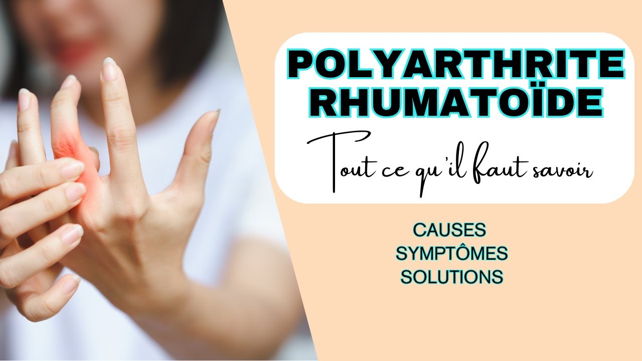 Polyarthrite rhumatoïde, tout ce qu'il faut savoir (causes, symptômes, solutions)