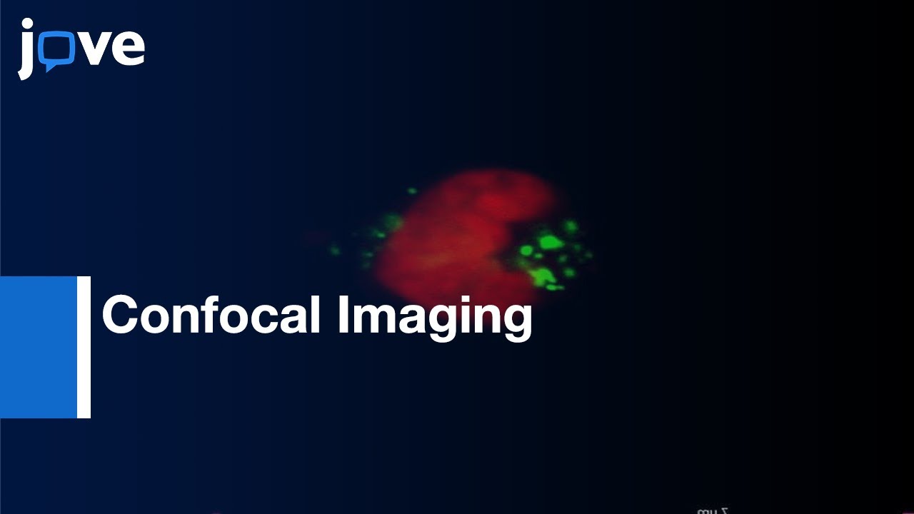 Confocal Imaging: Abnormal mitosis in cancer cells | Protocol Preview