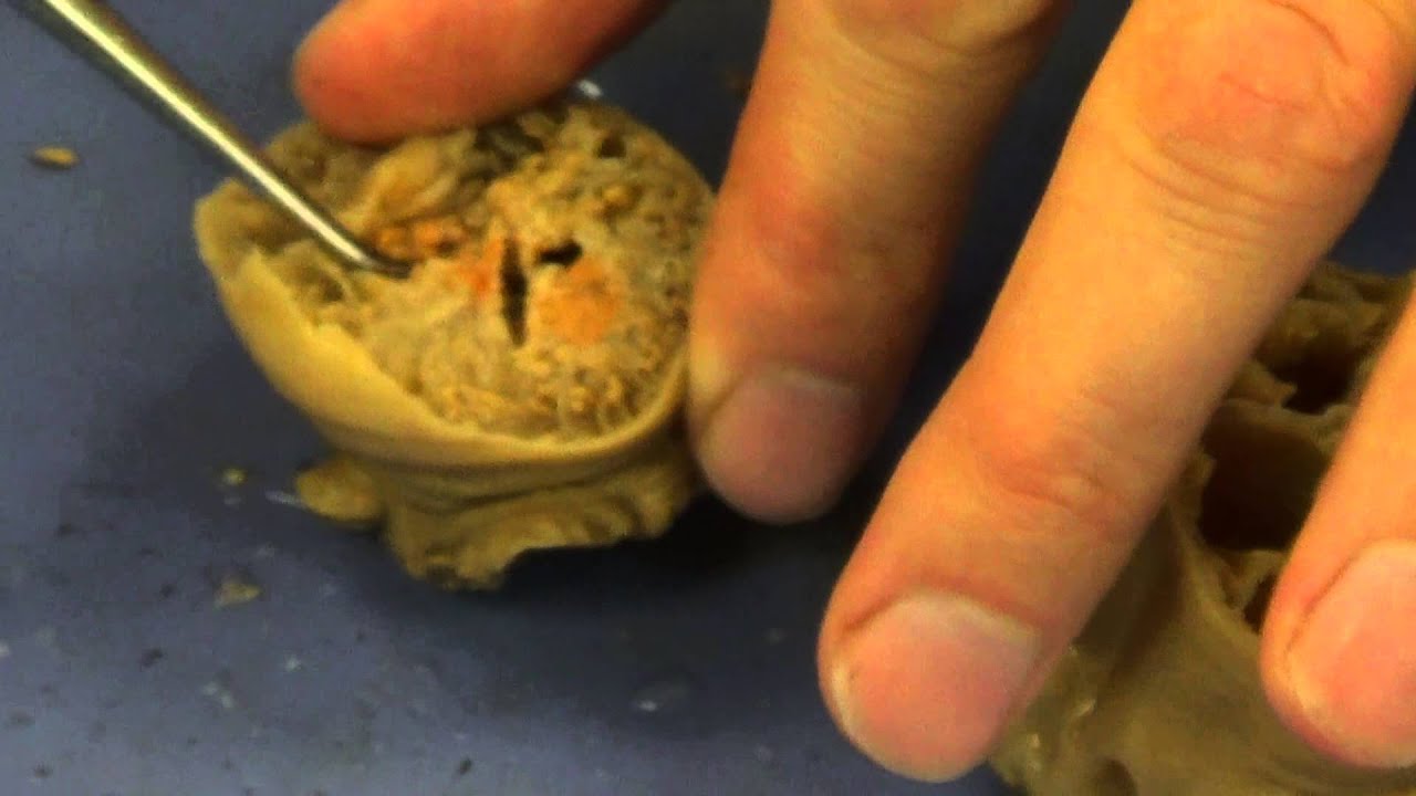 Sea Anemone Dissection