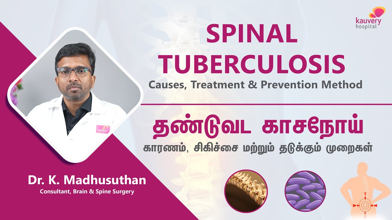 Spinal Tuberculosis - Causes, Treatment & Prevention | தண்டுவட காச நோய் – காரணங்கள் மற்றும் சிகிச்சை