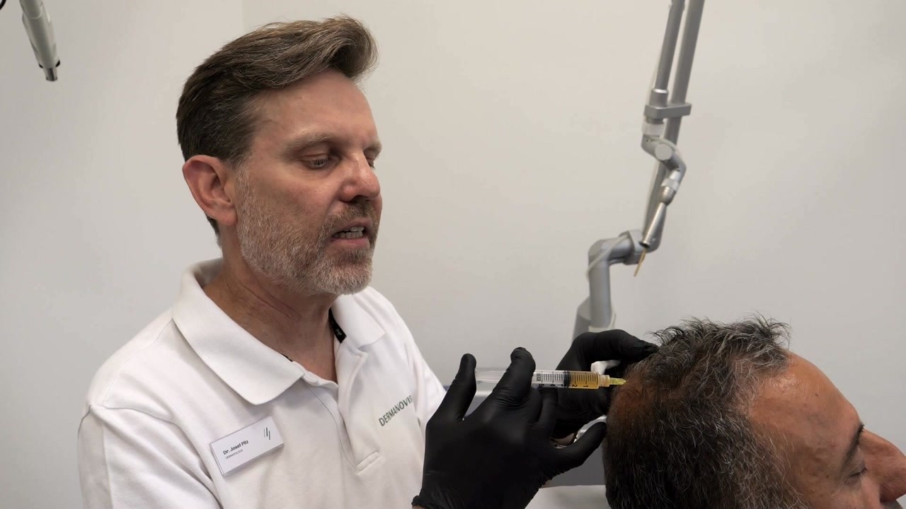 PRP - Eigenbluttherapie bei m&auml;nnlichen Haarausfall