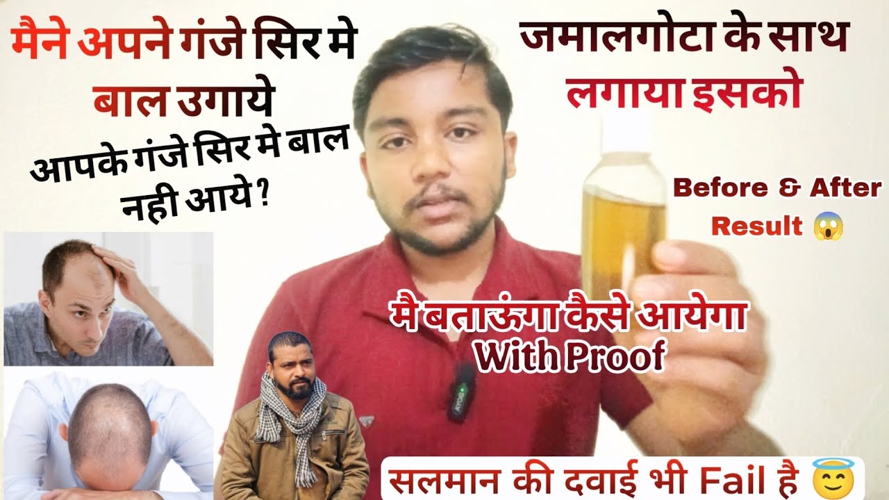 Jamalgota For Hair Treatment l जमालगोटा से गंजे सिर मे उगाये बाल l😱l #jamalgotaforhairtrratment  