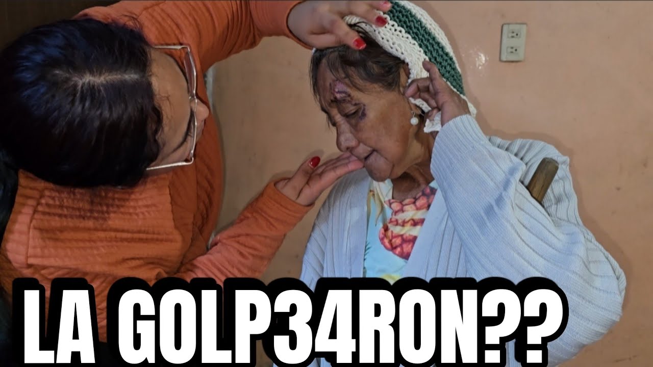 SE ME HIZO UN NUDO EN LA GARGANTA DE VERLA EN ESTA SITUACIÓN ¿QUE LE PASO? 🥺