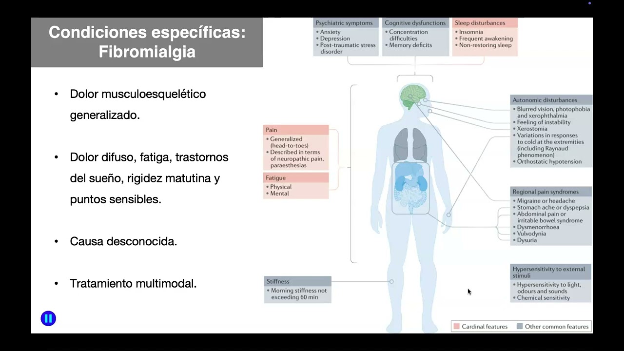 Dolor nociplástico