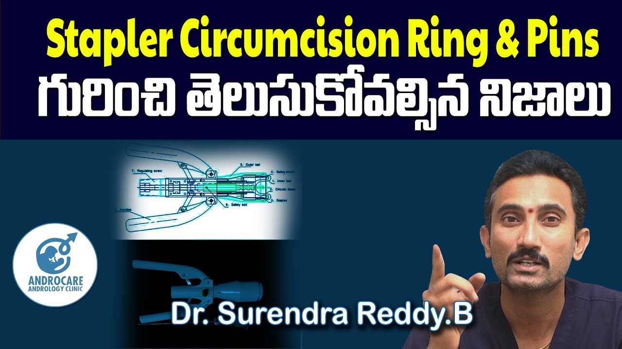 Stapler Circumcision గురించి తెలుసుకోవాల్సిన నిజాలు | Dr Surendra Reddy | Androcare Andrology Clinic