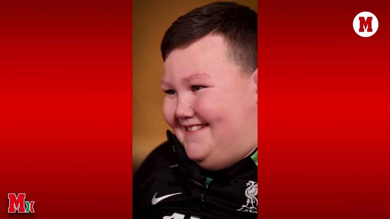 Jürgen Klopp y Liverpool y un emotivo video a Dáire, niño con discapacidad