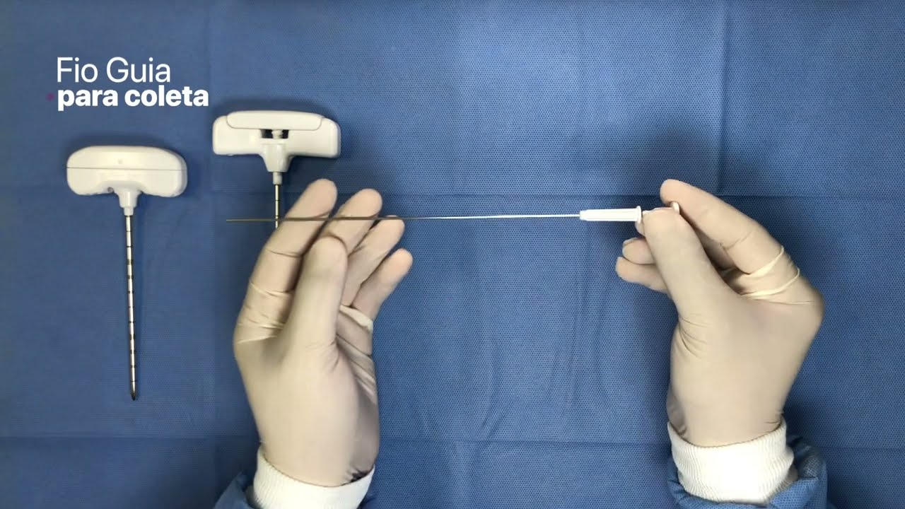 Cifoplastia t.Kypho - Passo a passo.