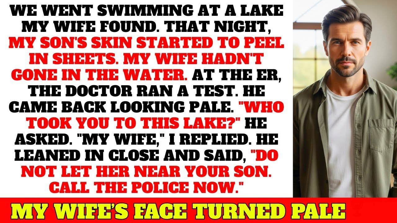 My WIfe Made Us Swim In a Lake, My Son's Skin Started Peeling... The Doctor Told Me To Call Cops