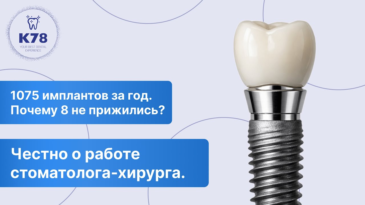 1075 имплантов за год. Почему 8 не прижились? Честно о работе стоматолога-хирурга.