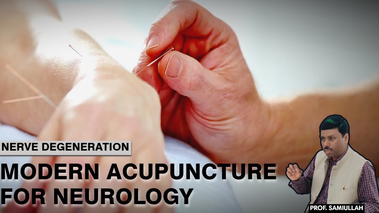 Nerve Degeneration -  How to treat with modern Acupuncture | Neurology - Prof Samiullah