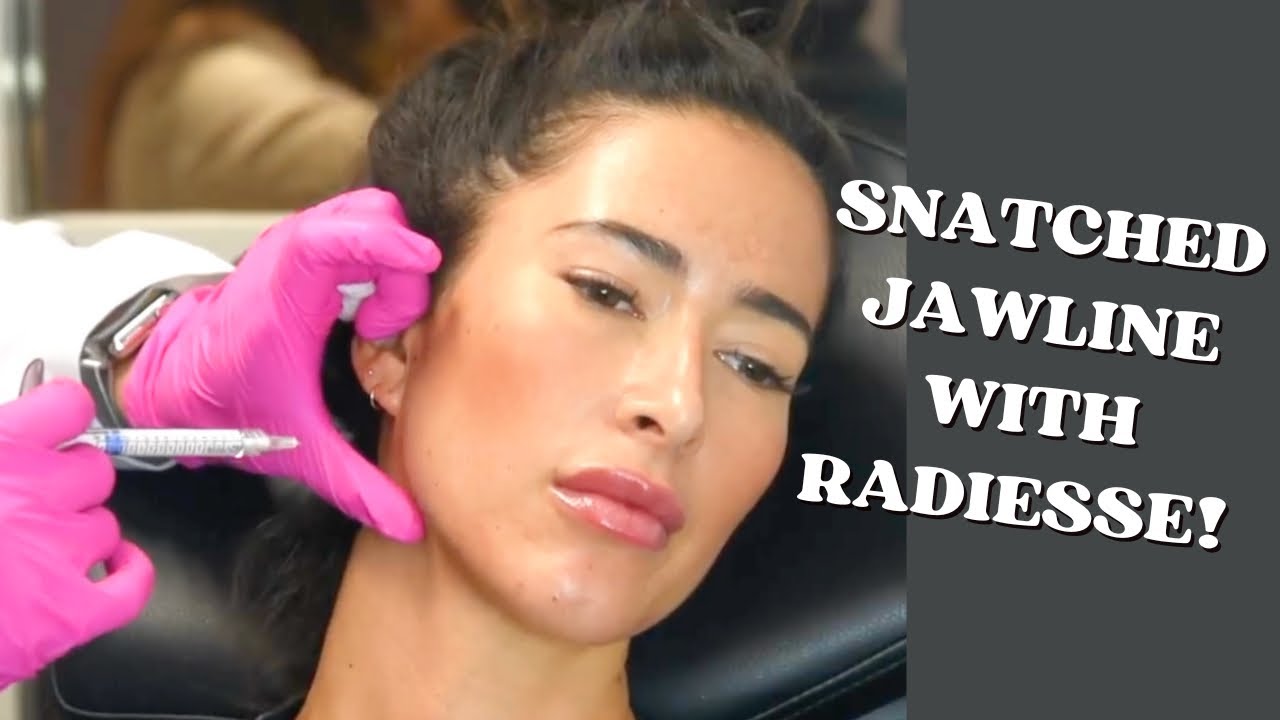 Как подтянуть линию подбородка с помощью Radiesse!