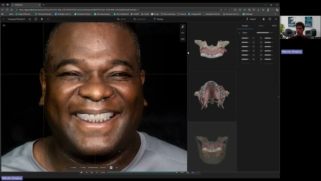 Как экспортировать дизайн Smilecloud 3DNA в coDiagnostiX