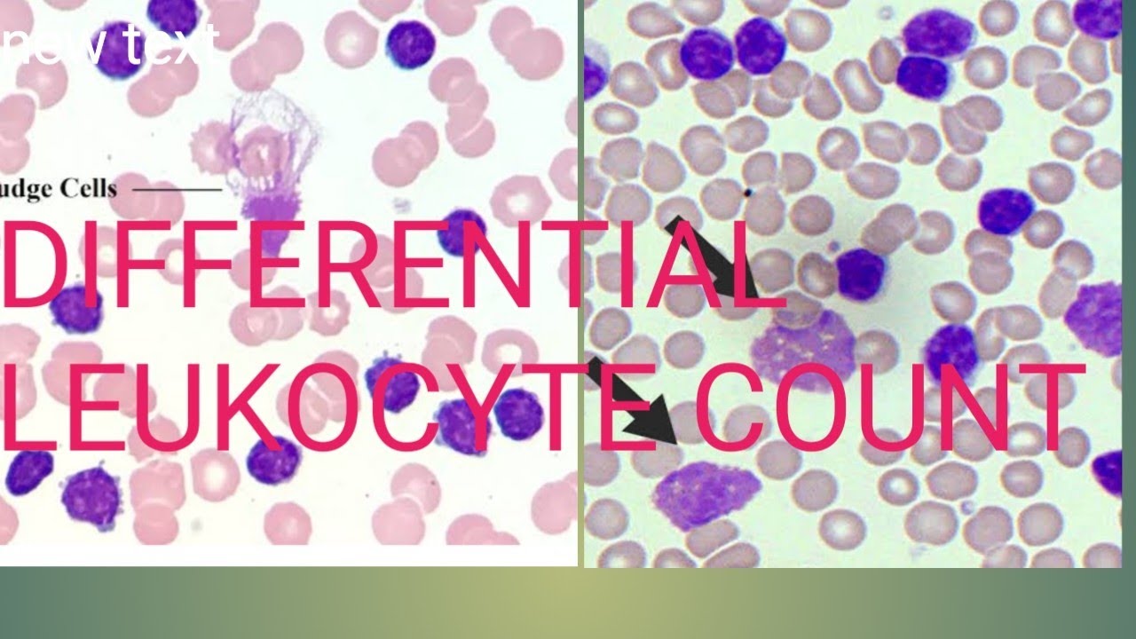 Differential Leukocyte Count DLC,DLC,WBC count,blood cells,#drnajeeb#viral#science#health #labtech