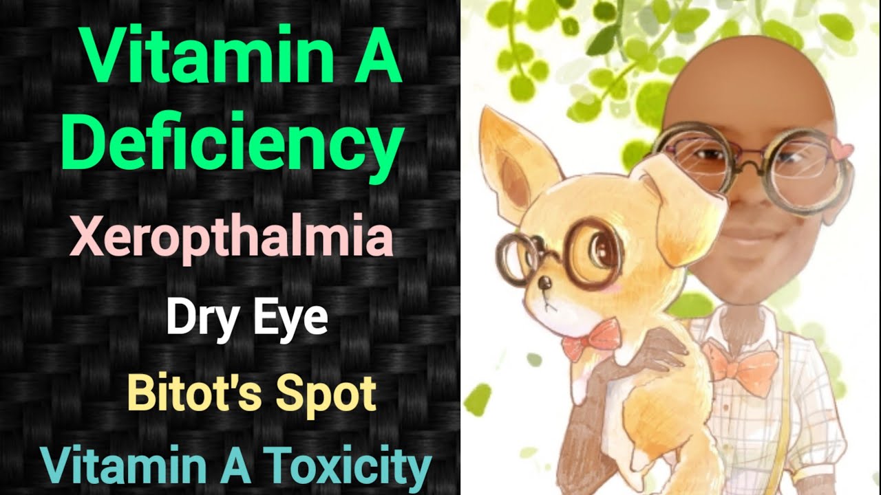 Vitamin A Deficiency | Xeropthalmia | PSM lecture | Community Medicine lecture | PSM made easy