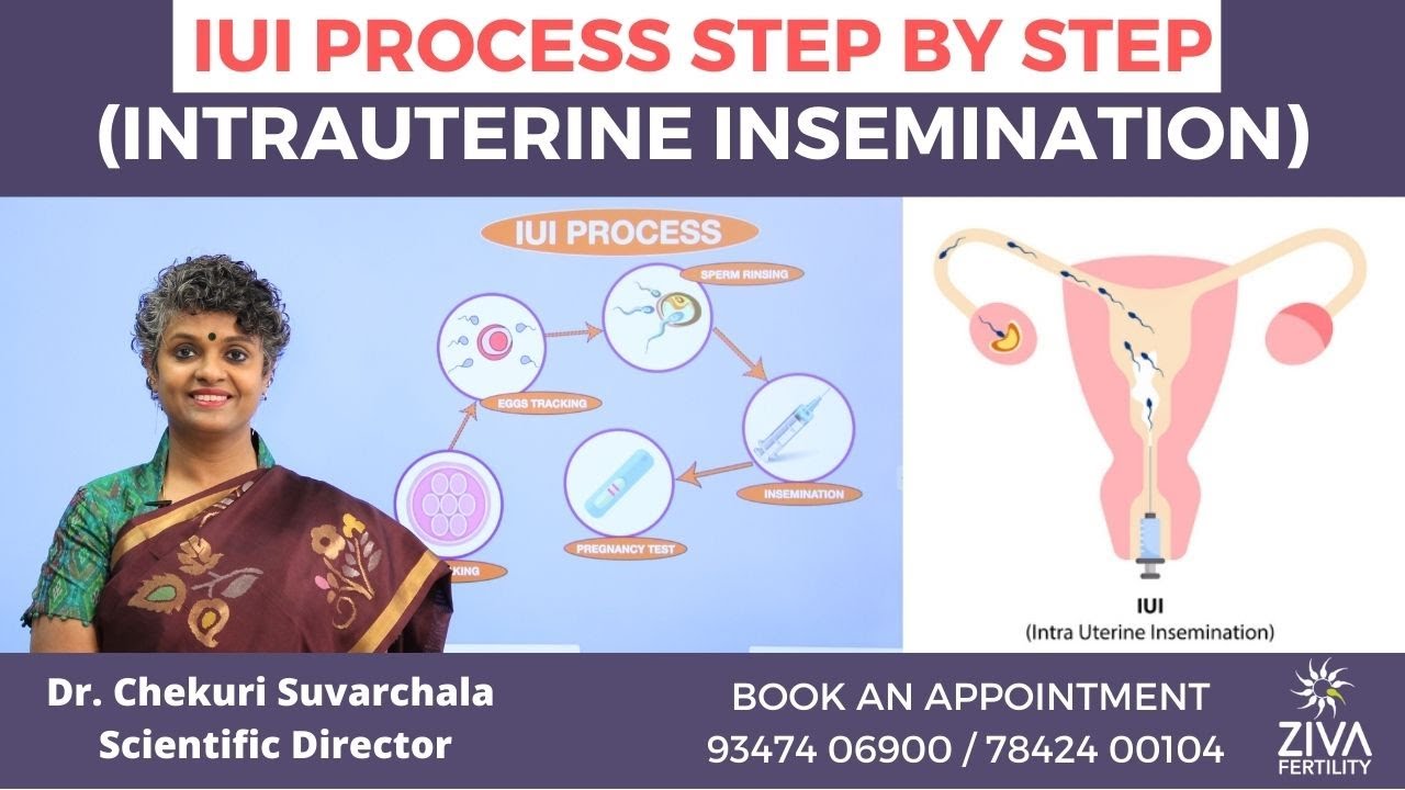 IUI Process Step By Step | Intrauterine Insemination | Dr Chekuri Suvarchala | ZIVA Fertility