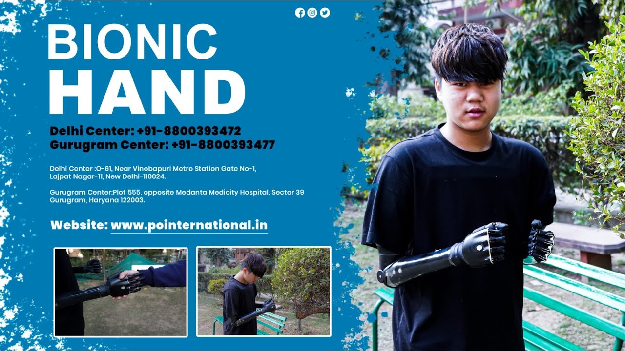 Bilateral Bionic Hand Prosthesis | Grip, Control & Confidence #bionichand  | P&O International
