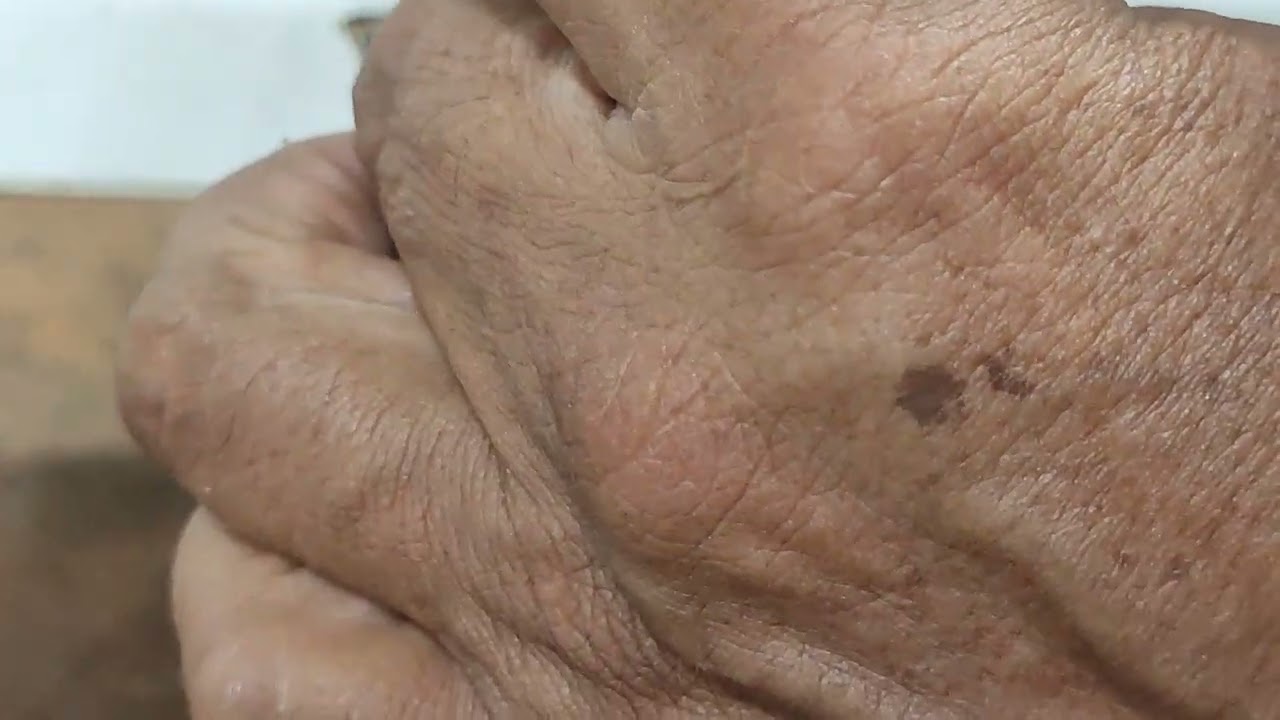 reemplazar piñón dé fibra por metálico
