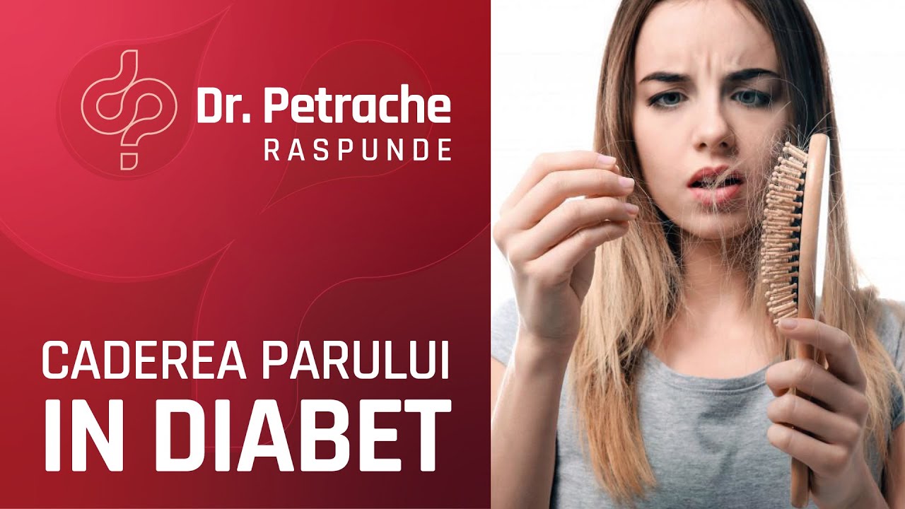SOLUTII PENTRU CADEREA PARULUI IN DIABET