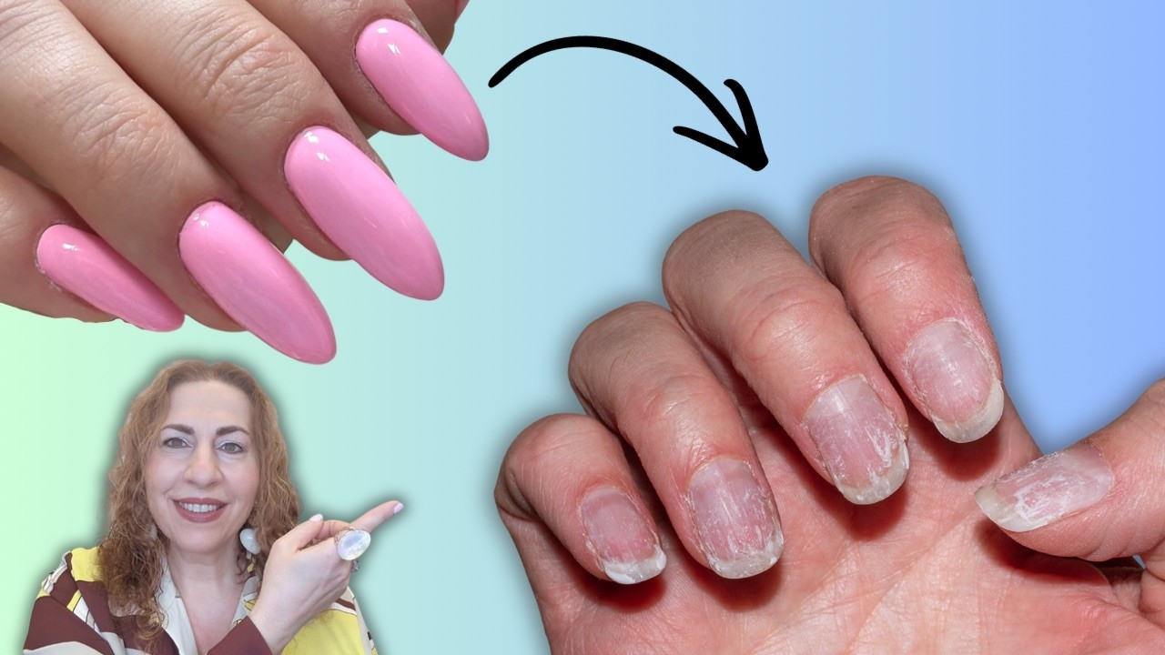 Dangers of Gel and Acrylic Nails | A Doctor’s Perspective