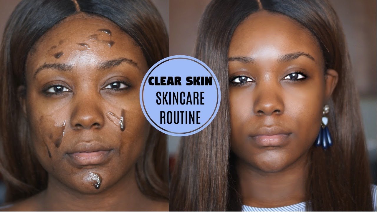 OILY SKIN ACNE SKIN CARE ROUTINE - Dark Spots / Pores to Clear Skin (DRUGSTORE 2018) - Rose Kimberly