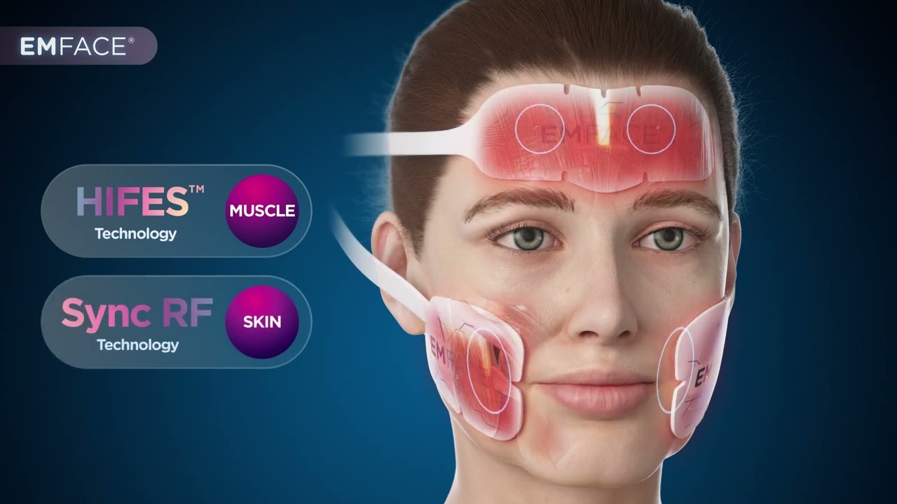 EMFACE Mechanism of Action