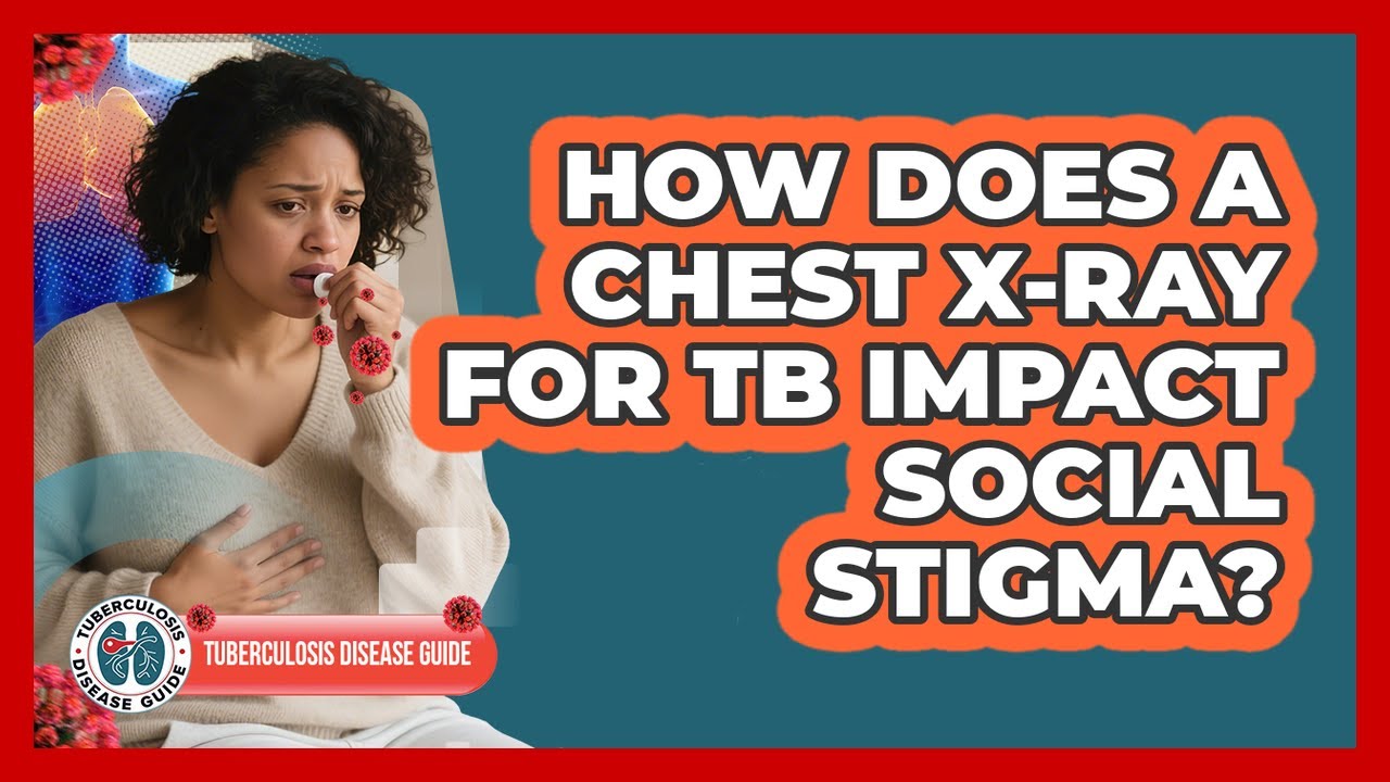 How Does A Chest X-ray For TB Impact Social Stigma? - Tuberculosis Disease Guide