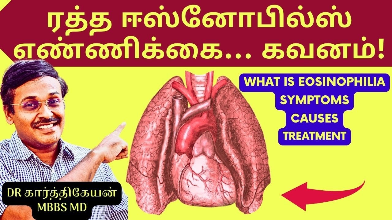 eosinophilia symptoms asthma allergy treatment tamil | Doctor Karthikeyan