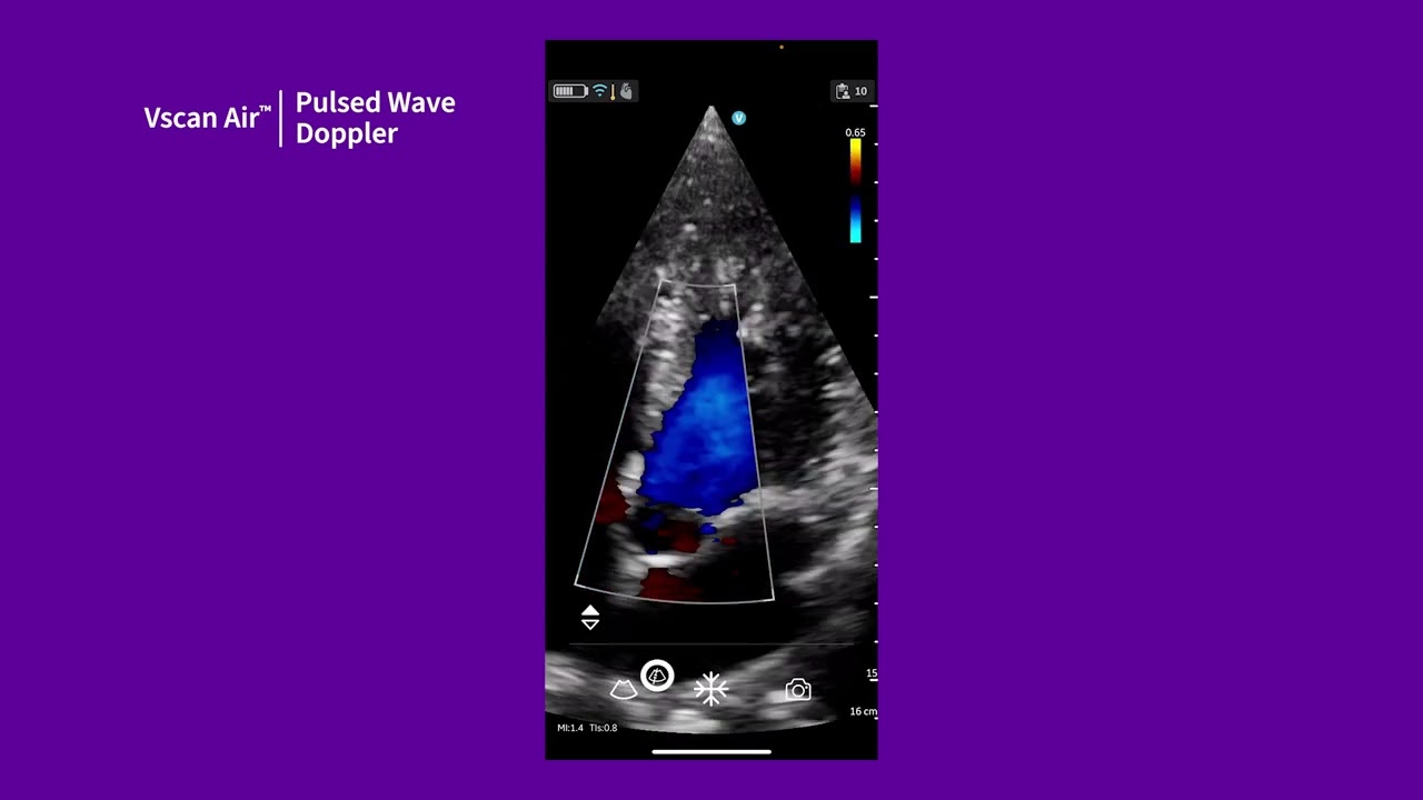 Vscan Air™ Tutorials | Pulsed Wave Doppler