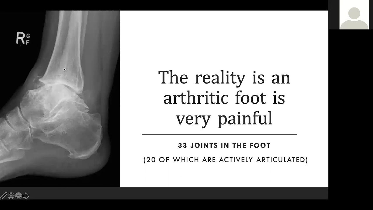 Understanding the Aging Foot & its Effect on Movement with Dr Emily Splichal