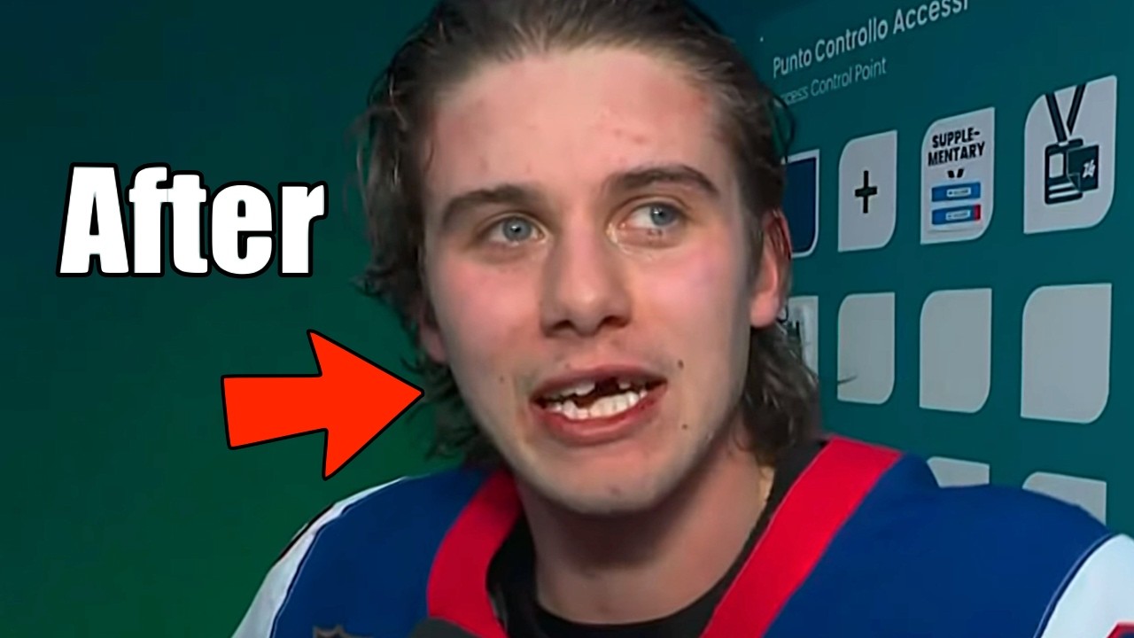Jack Hughes Trades Teeth For Olympic Gold - Doctor Explains