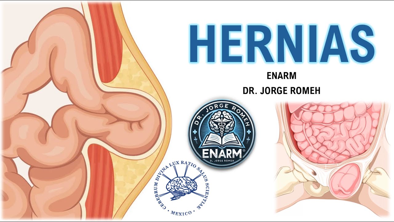 HERNIAS - ENARM - TODO LO QUE DEBES SABER