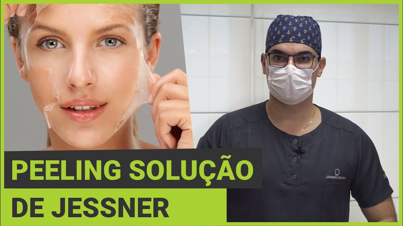Peeling Solução de Jessner
