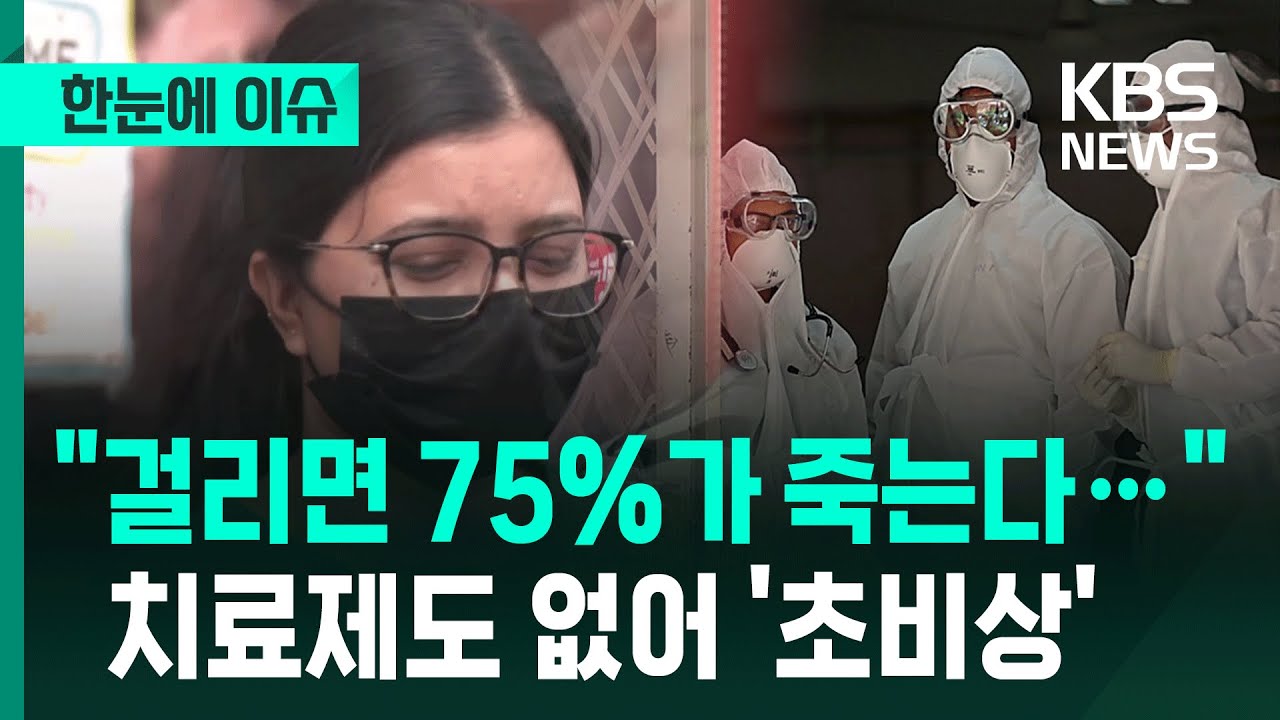 [한눈에 이슈] 