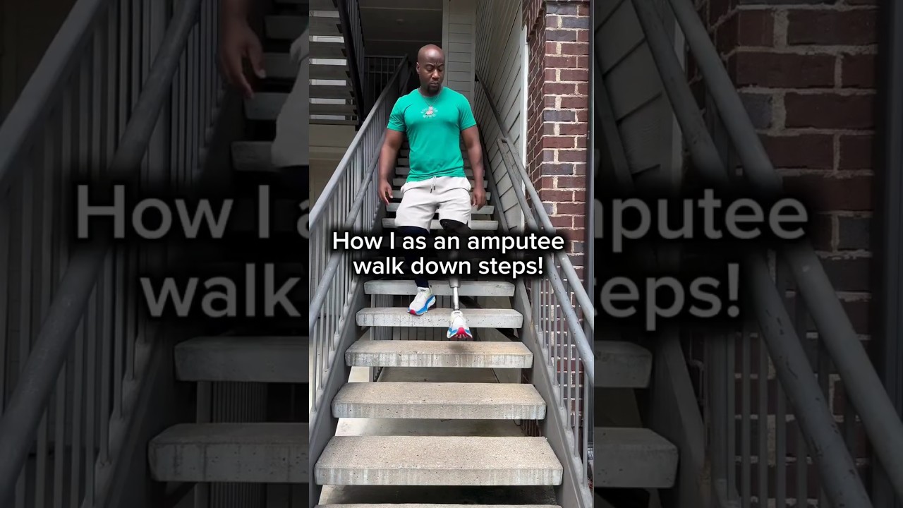 Empowering Mobility: Above-Knee Amputation & Artificial Limb for Enhanced