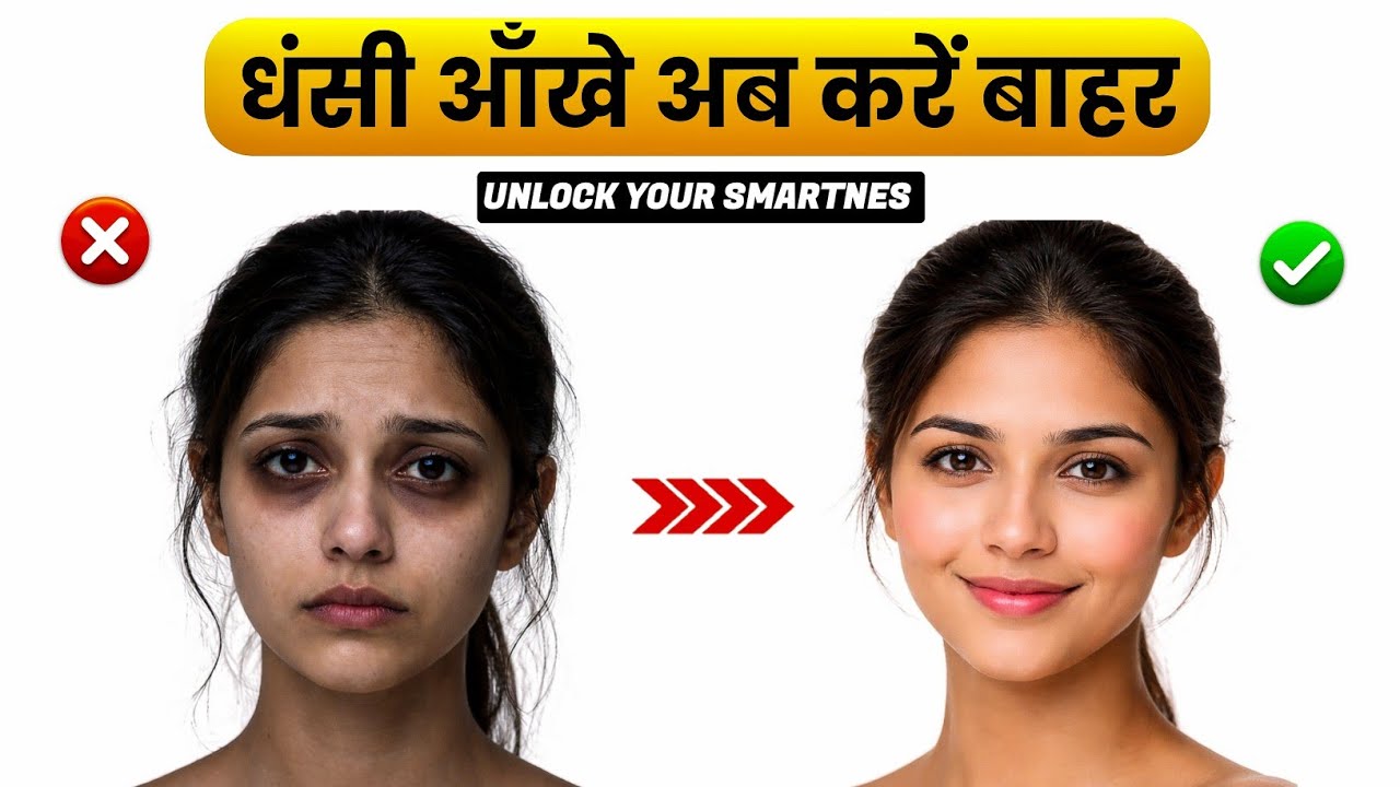 18–30 Age में आंखें अंदर धंस रही हैं? | Dark Circles का Medical Solution मात्र 7 दिन मे 