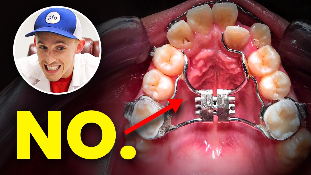 Are orthodontic expanders worth the money?