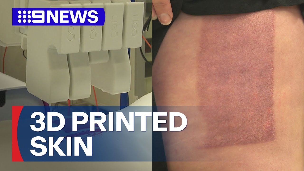 World-first breakthrough could change the lives of burn victims | 9 News Australia