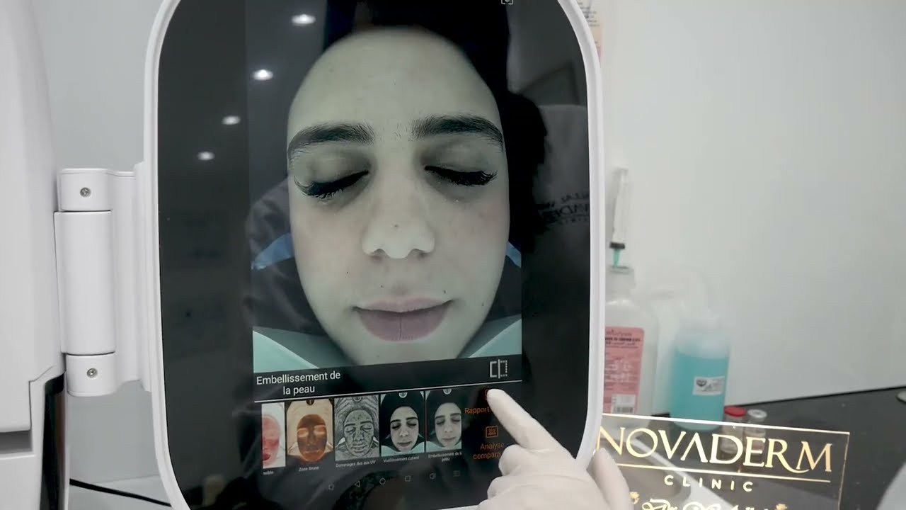 Analyseur de scanner facial 3D pour syst&egrave;me de diagnostic de la peau